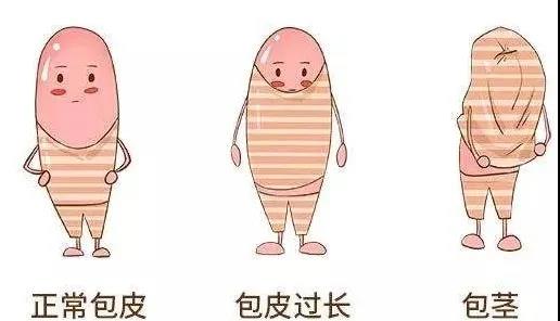 【保山安利醫(yī)院】家長(zhǎng)速看！暑期包皮手術(shù)預(yù)約正當(dāng)時(shí)！